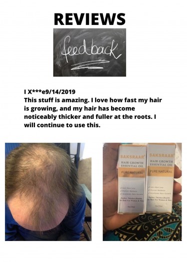 Are You Worried About Hair Loss? - Call Shawn Now!