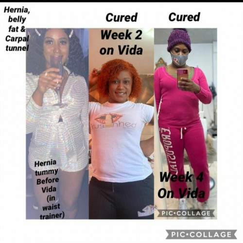 Tedivina Detox Tea & Supplement For PCOS Fibroid