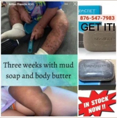 Mud Soap And Body Butter
