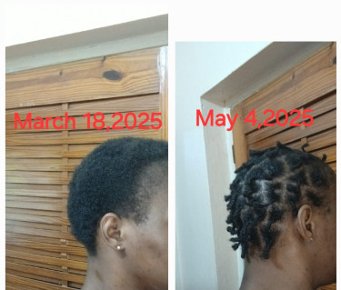 Hair Growth Serum 
