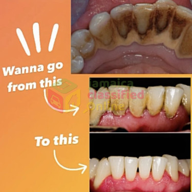 Dental Cleanings Healthcare Services Shop #12, MasterMac SuperCenter, 110 Constant Spring Rd, Kingston