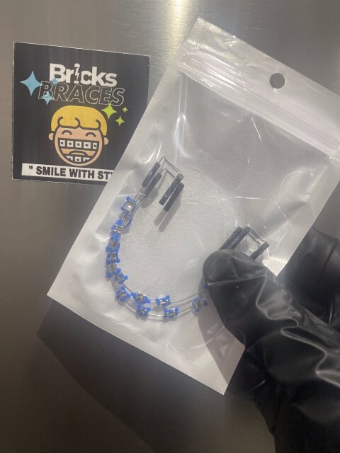 Fake Temporary Clip On Braces Other Market Spanish Town