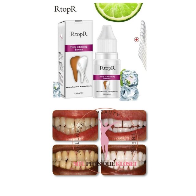Mini Teeth Whitening Kit First Aid Equipment & Supplies Port Antonio | KGN | Ocho Rios | Stmary
