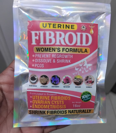 HEAL FROM ALL WOMB ISSUES WITHOUT SURGERY Women's Clothes Portmore